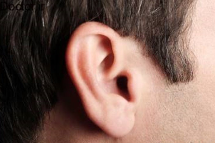 مو روی لاله گوش نشانه چیست؟